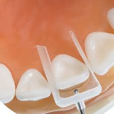 IVeneer Injectable